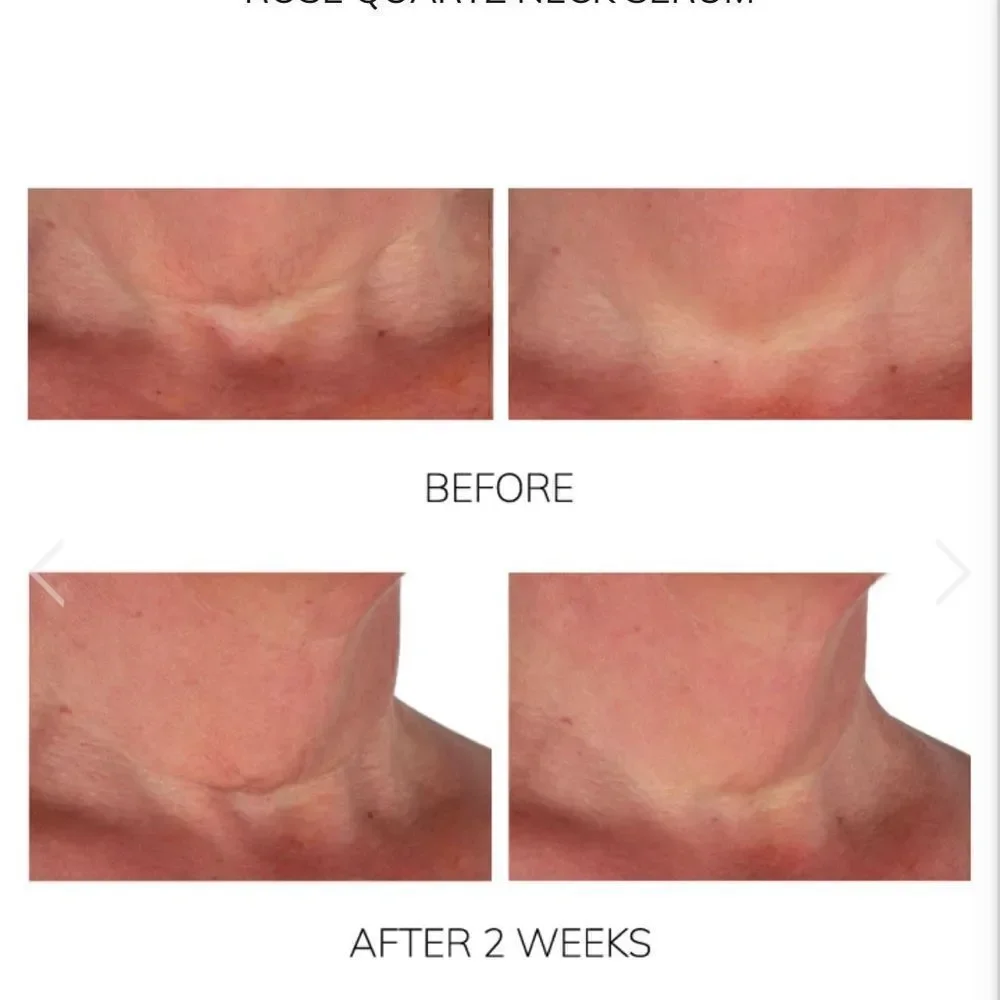DIAMOND CONTOUR LIFTING ROSE QUARTZ NECK SERUM Firming Treatment + Youth…